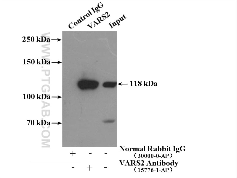 Immunoprecipitation (IP) experiment of HeLa cells using VARS2 Polyclonal antibody (15776-1-AP)