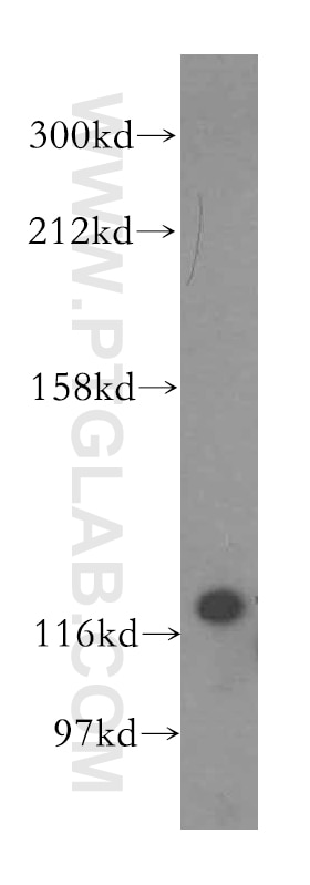 Western Blot (WB) analysis of human brain tissue using VARS2 Polyclonal antibody (15776-1-AP)