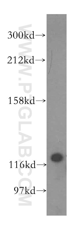 WB analysis of human brain using 15776-1-AP