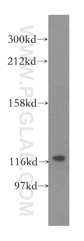Western Blot (WB) analysis of HeLa cells using VARS2 Polyclonal antibody (15776-1-AP)