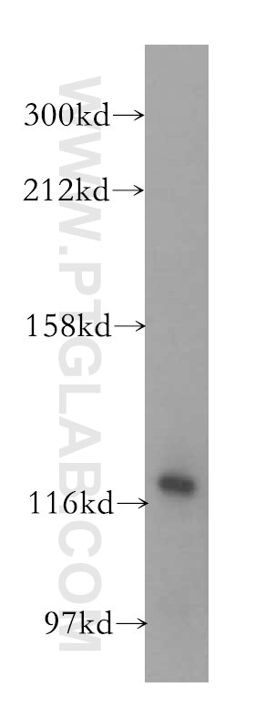 Western Blot (WB) analysis of human liver tissue using VARS2 Polyclonal antibody (15776-1-AP)