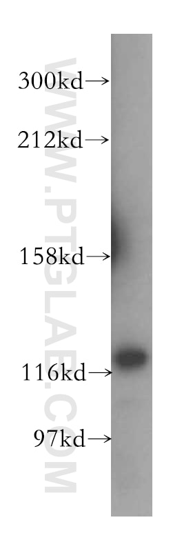Western Blot (WB) analysis of Jurkat cells using VARS2 Polyclonal antibody (15776-1-AP)