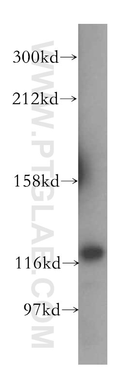 WB analysis of Jurkat using 15776-1-AP