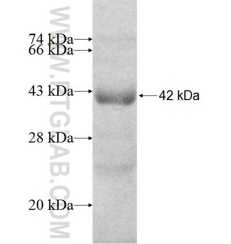 VARS2 fusion protein Ag8457 SDS-PAGE