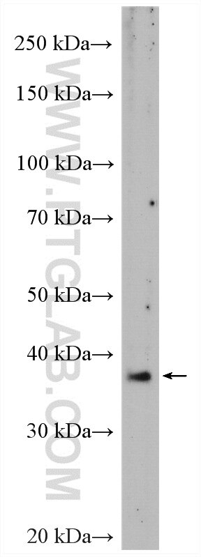 Western Blot (WB) analysis of HeLa cells using VASH1 Polyclonal antibody (12730-1-AP)