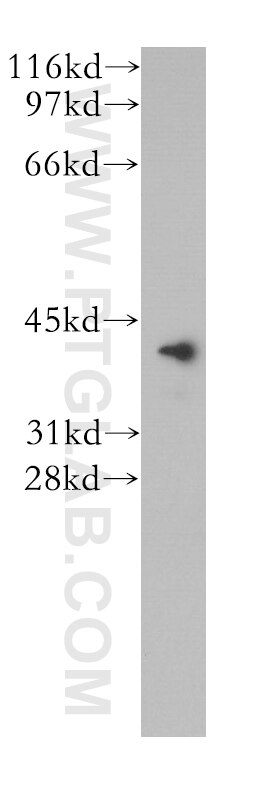 Western Blot (WB) analysis of human brain tissue using VASH1 Polyclonal antibody (12730-1-AP)