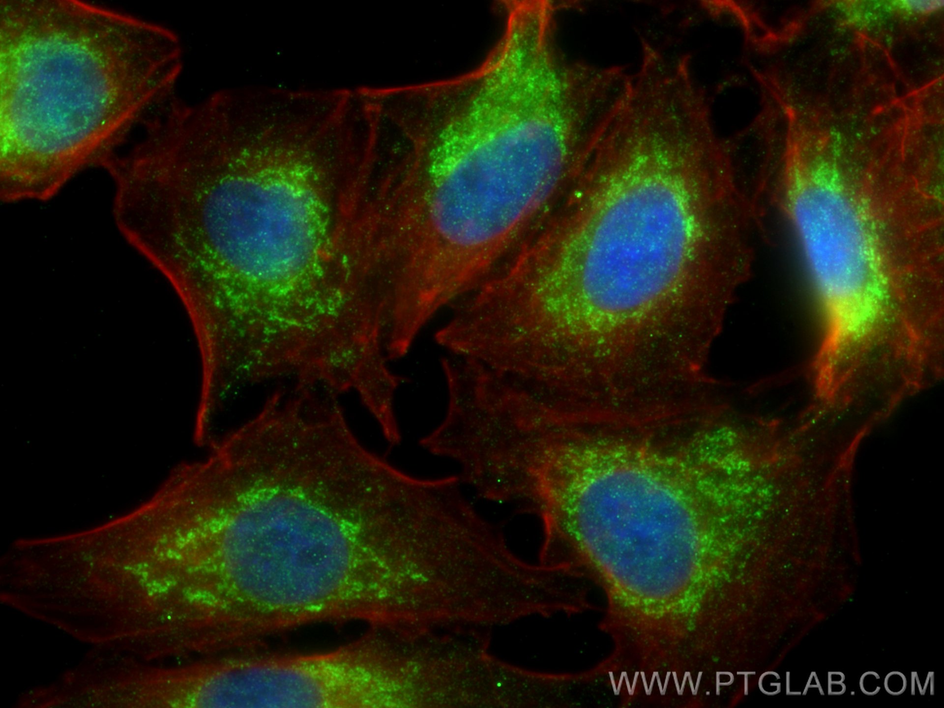 Immunofluorescence (IF) / fluorescent staining of A549 cells using VASH2 Polyclonal antibody (13303-1-AP)