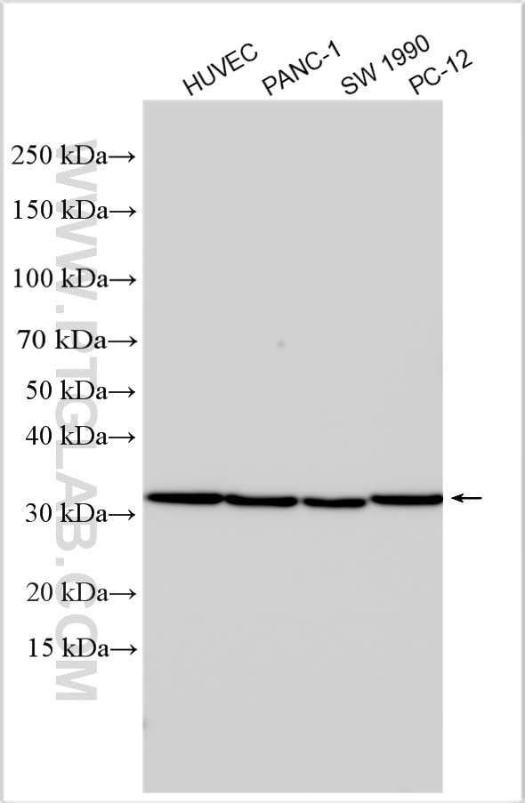 Western Blot (WB) analysis of various lysates using VASH2 Polyclonal antibody (13303-1-AP)