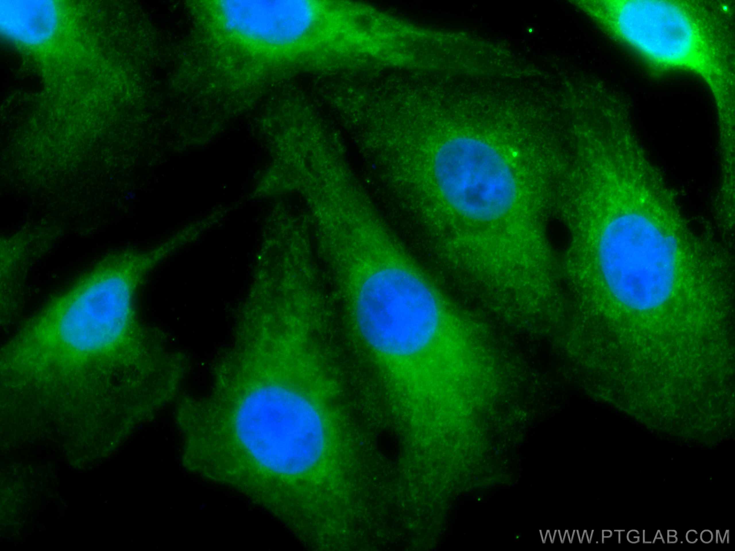 Immunofluorescence (IF) / fluorescent staining of SKOV-3 cells using CoraLite® Plus 488-conjugated VASH2 Monoclonal ant (CL488-67753)