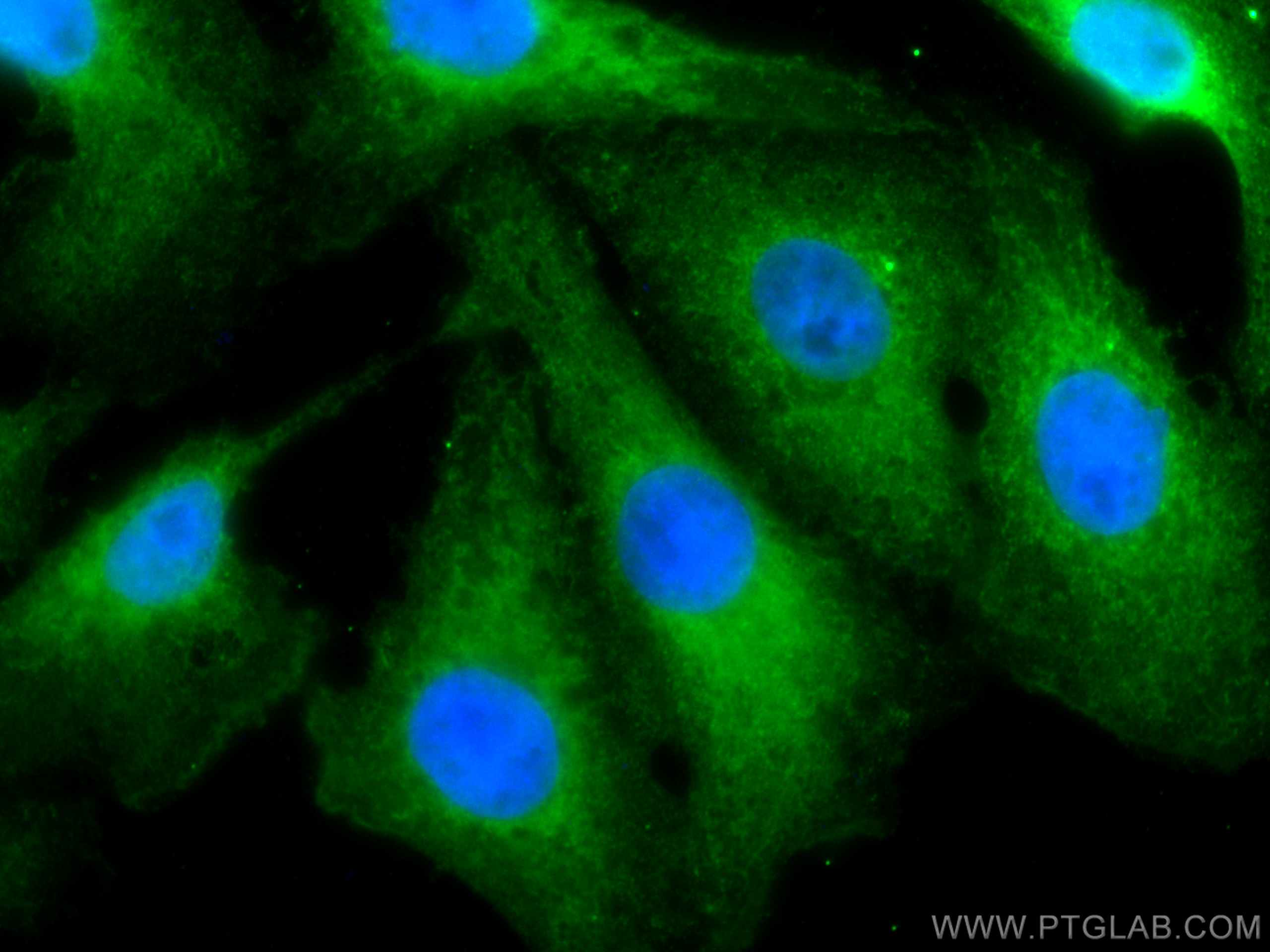 IF Staining of SKOV-3 using CL488-67753