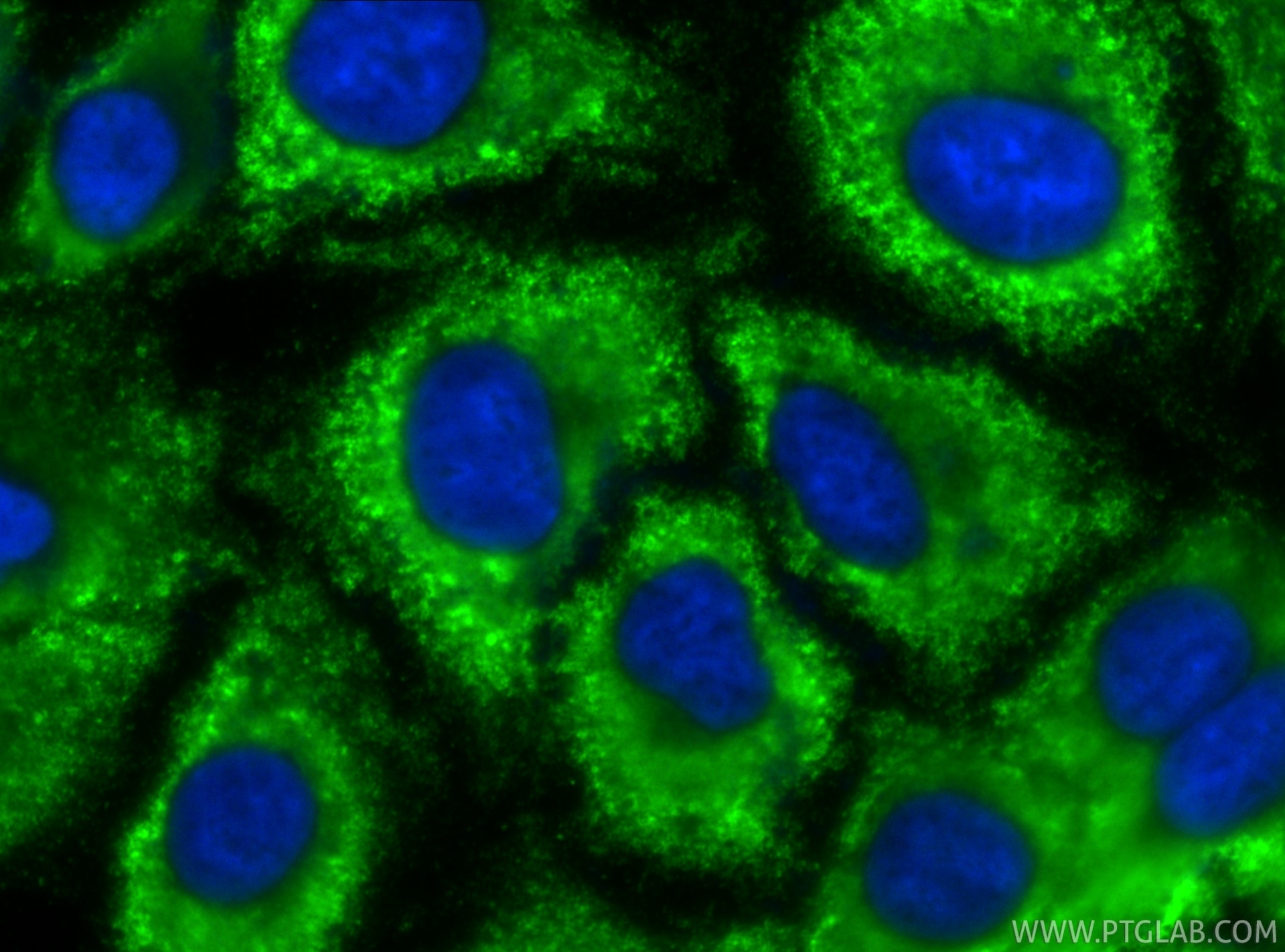 Immunofluorescence (IF) / fluorescent staining of A549 cells using CoraLite® Plus 488-conjugated VASH2 Monoclonal ant (CL488-67753)