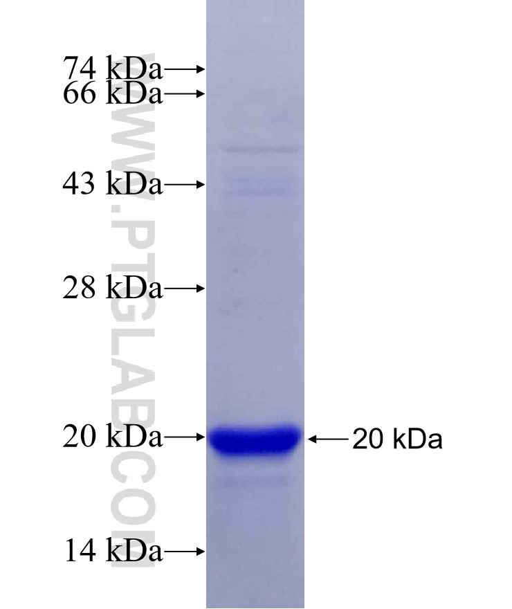 VASH2 fusion protein Ag29985 SDS-PAGE