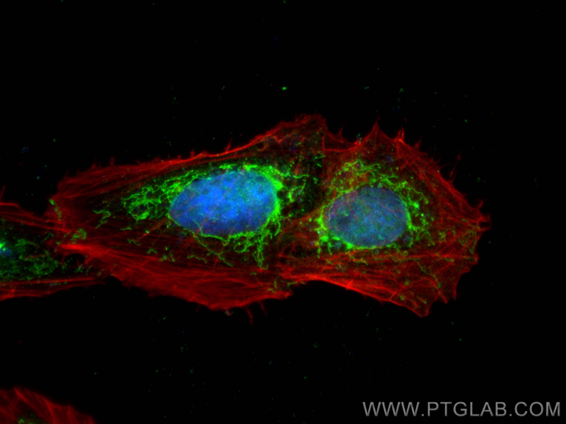 IF Staining of U2OS using 17714-1-AP Immunofluorescence (IF) / fluorescent staining of U2OS cells using VASN Polyclonal antibody (17714-1-AP)