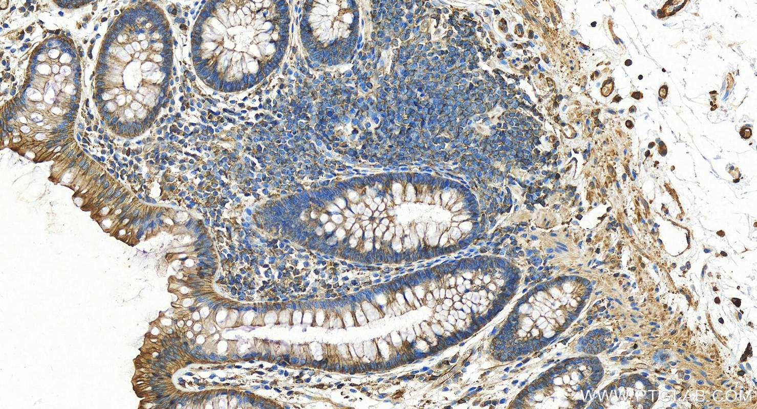 Immunohistochemistry (IHC) staining of human colon tissue using VASP Polyclonal antibody (13472-1-AP)