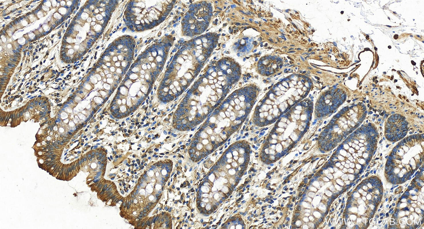 Immunohistochemistry (IHC) staining of human colon tissue using VASP Polyclonal antibody (13472-1-AP)