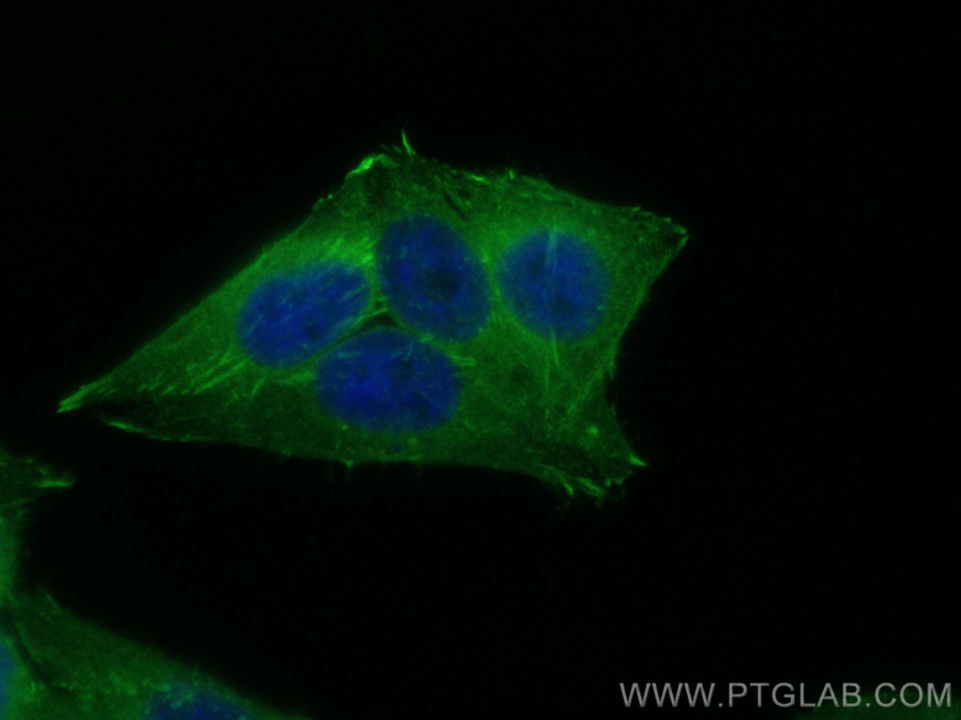 Immunofluorescence (IF) / fluorescent staining of HepG2 cells using VASP Polyclonal antibody (13472-1-AP)