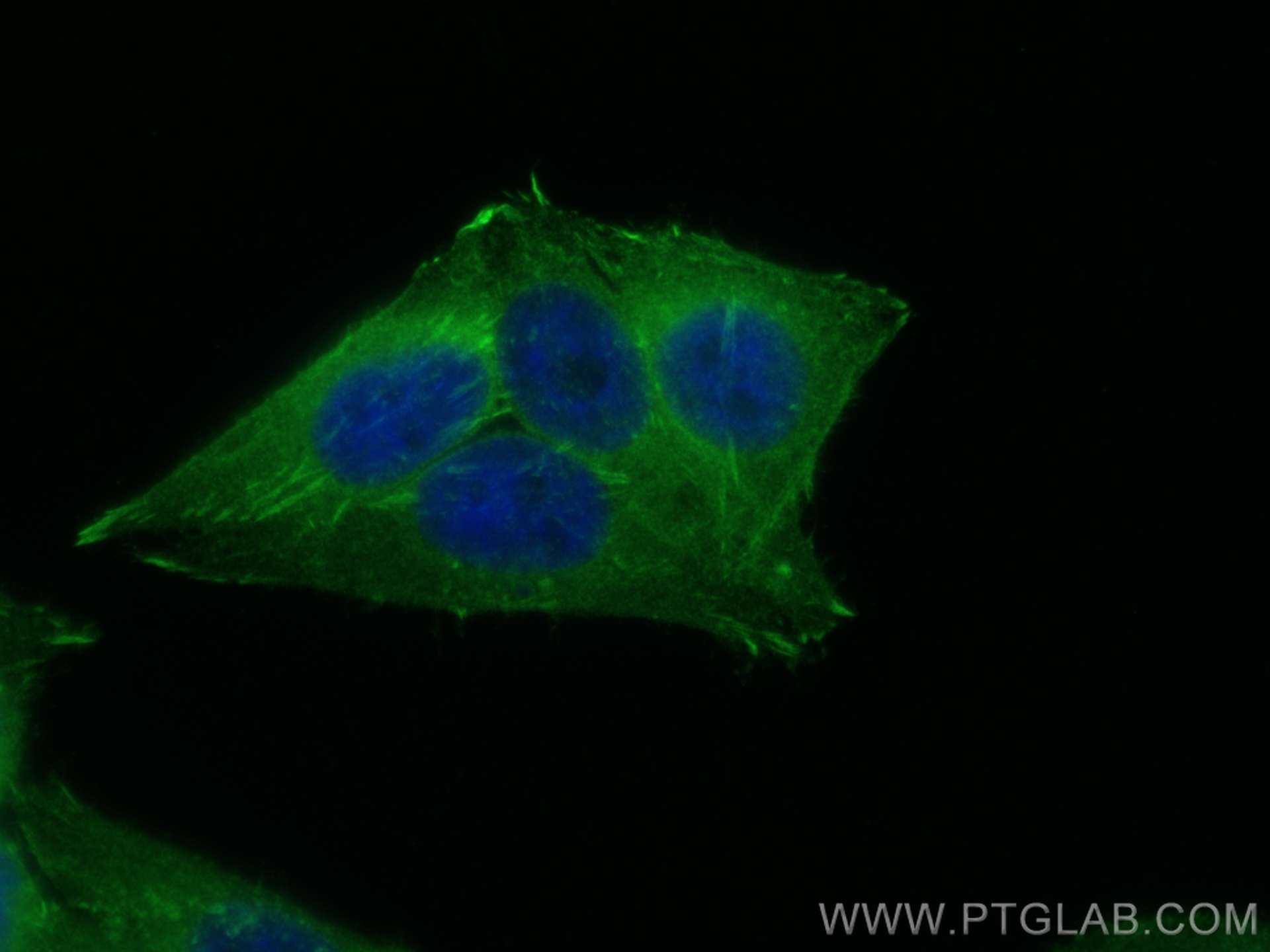 IF Staining of HepG2 using 13472-1-AP