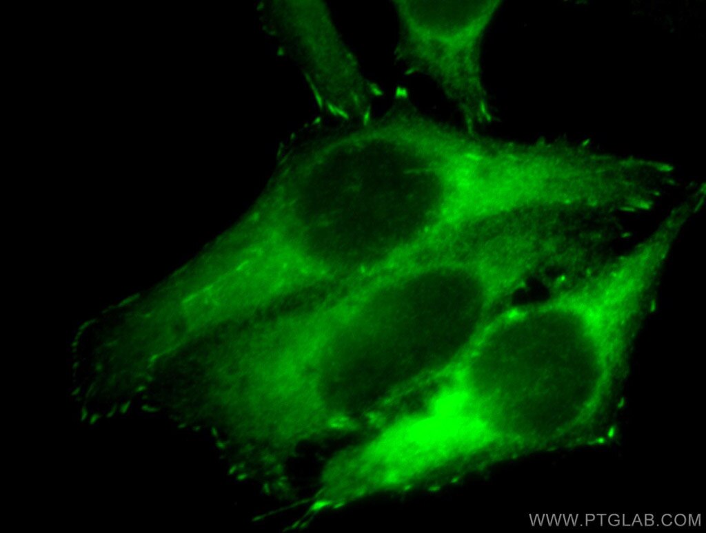 VASP Polyclonal antibody