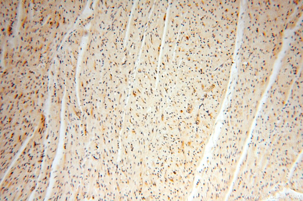 Immunohistochemistry (IHC) staining of human heart tissue using VASP Polyclonal antibody (13472-1-AP)