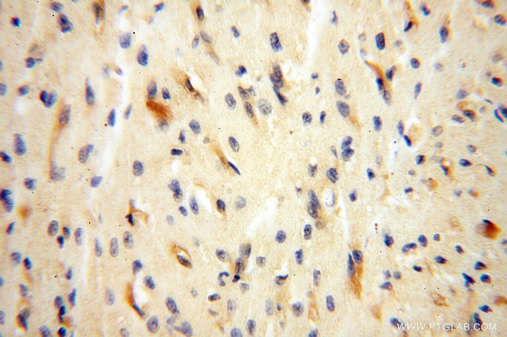 Immunohistochemistry (IHC) staining of human heart tissue using VASP Polyclonal antibody (13472-1-AP)