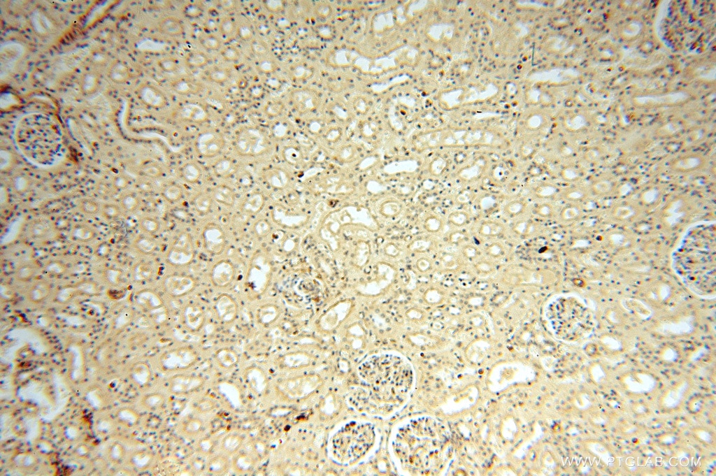 Immunohistochemistry (IHC) staining of human kidney tissue using VASP Polyclonal antibody (13472-1-AP)