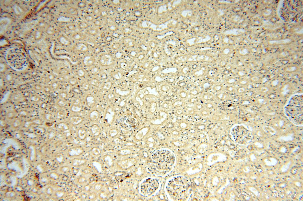 Immunohistochemistry (IHC) staining of human kidney tissue using VASP Polyclonal antibody (13472-1-AP)