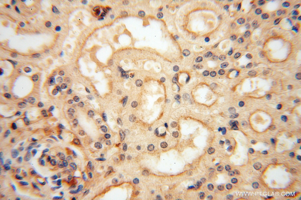 Immunohistochemistry (IHC) staining of human kidney tissue using VASP Polyclonal antibody (13472-1-AP)