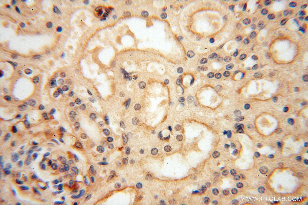 IHC staining of human kidney using 13472-1-AP