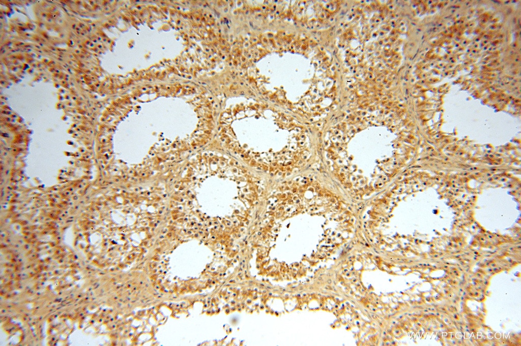Immunohistochemistry (IHC) staining of human testis tissue using VASP Polyclonal antibody (13472-1-AP)