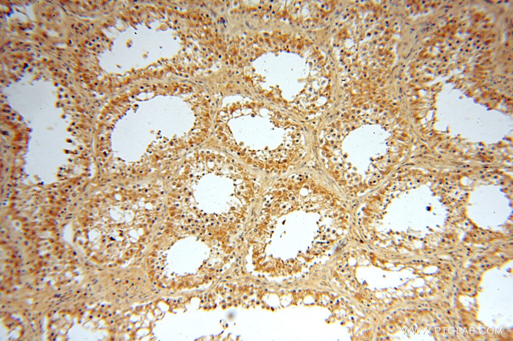 IHC staining of human testis using 13472-1-AP