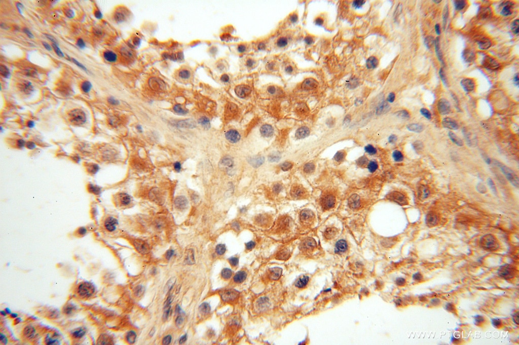 Immunohistochemistry (IHC) staining of human testis tissue using VASP Polyclonal antibody (13472-1-AP)