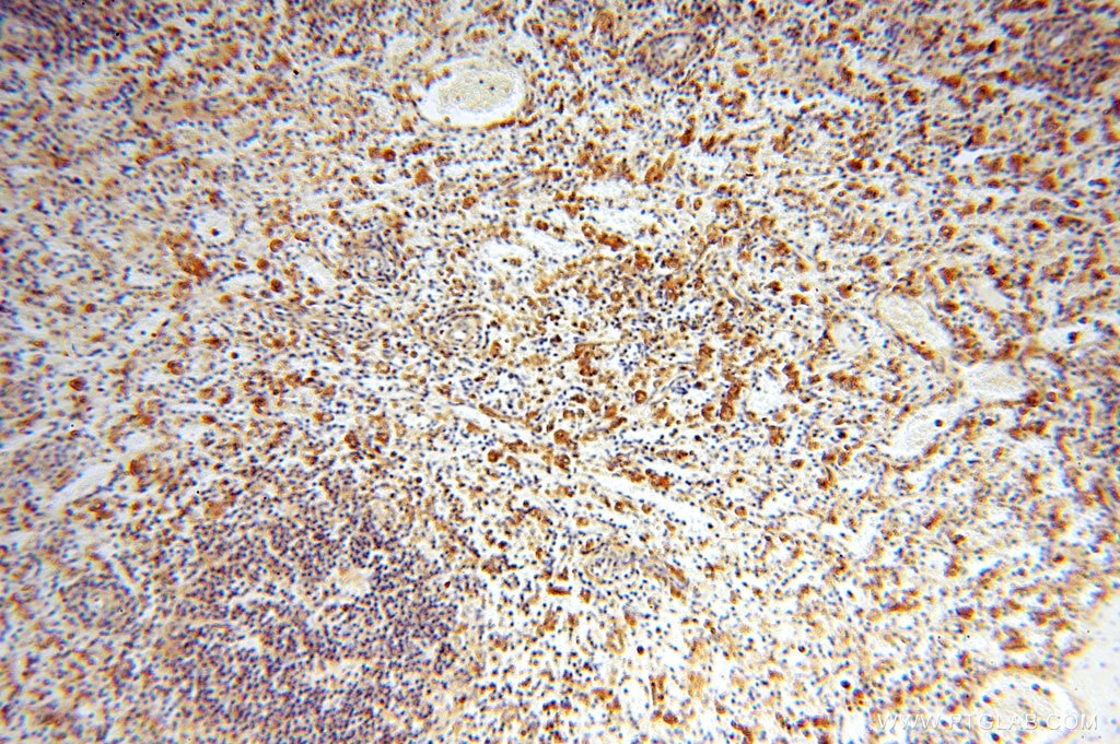Immunohistochemistry (IHC) staining of human spleen tissue using VASP Polyclonal antibody (13472-1-AP)