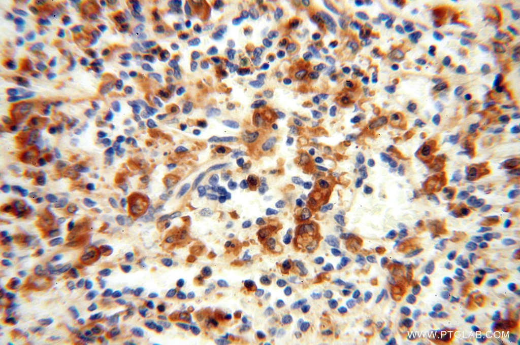 Immunohistochemistry (IHC) staining of human spleen tissue using VASP Polyclonal antibody (13472-1-AP)