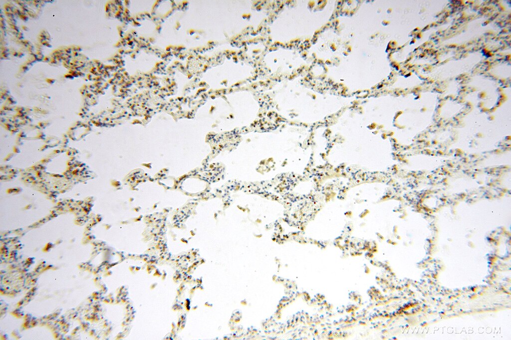 Immunohistochemistry (IHC) staining of human lung tissue using VASP Polyclonal antibody (13472-1-AP)