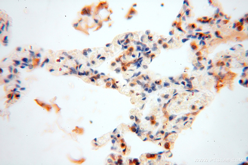 IHC staining of human lung using 13472-1-AP