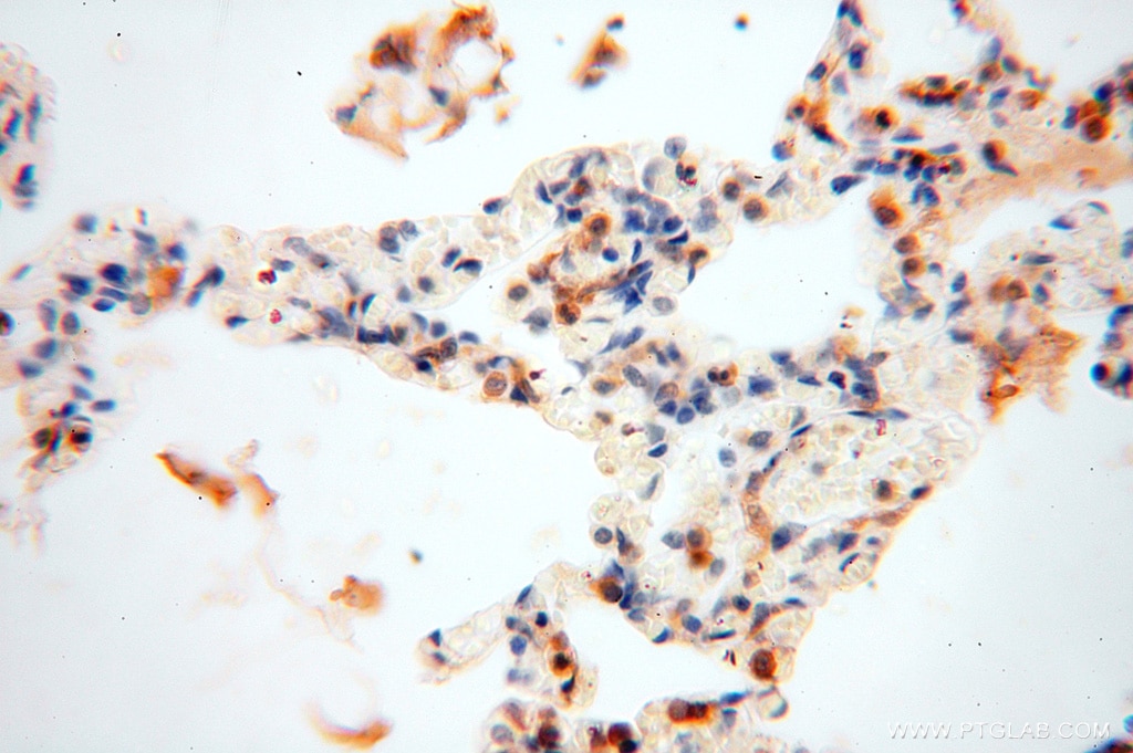 Immunohistochemistry (IHC) staining of human lung tissue using VASP Polyclonal antibody (13472-1-AP)