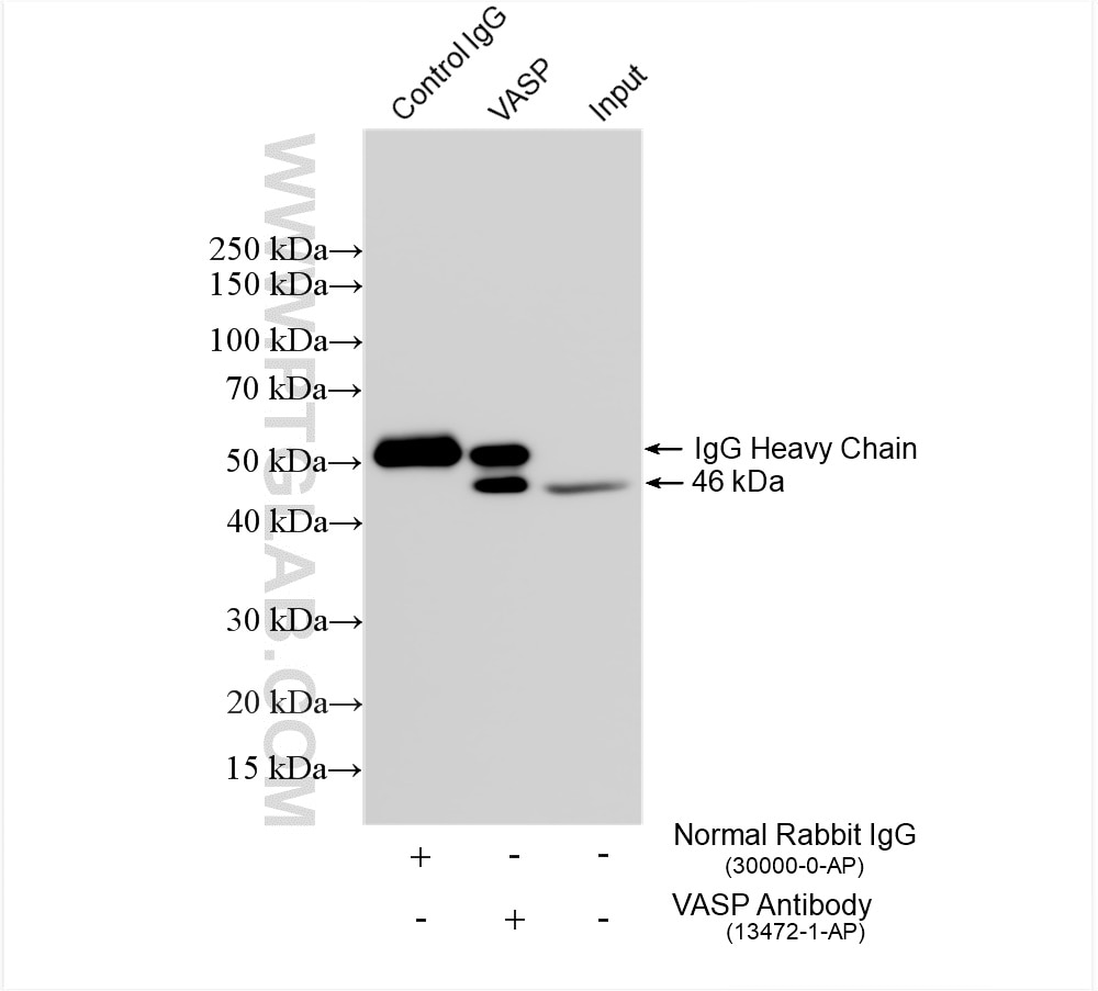 Immunoprecipitation (IP) experiment of HEK-293 cells using VASP Polyclonal antibody (13472-1-AP)
