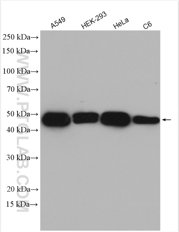 Western Blot (WB) analysis of various lysates using VASP Polyclonal antibody (13472-1-AP)