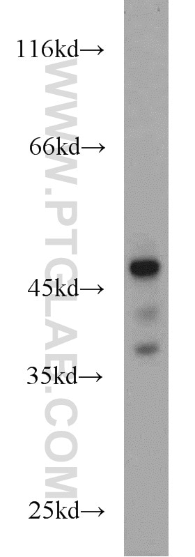 Western Blot (WB) analysis of mouse spleen tissue using VASP Polyclonal antibody (13472-1-AP)