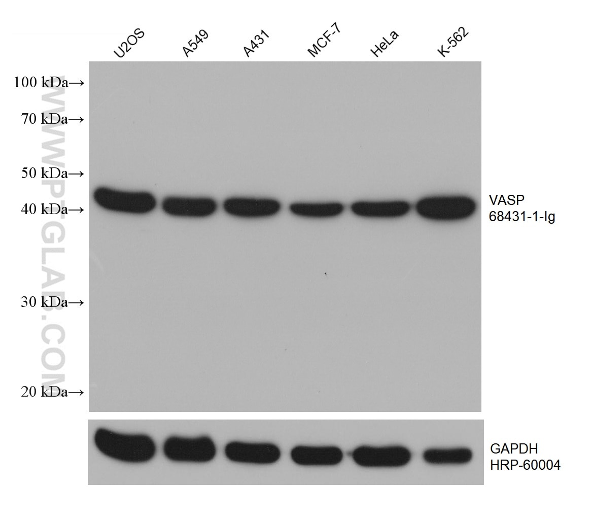 WB analysis using 68431-1-Ig