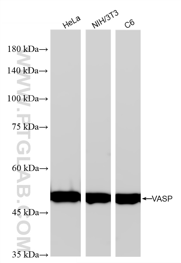 Western Blot (WB) analysis of various lysates using VASP Recombinant monoclonal antibody (87104-3-RR)