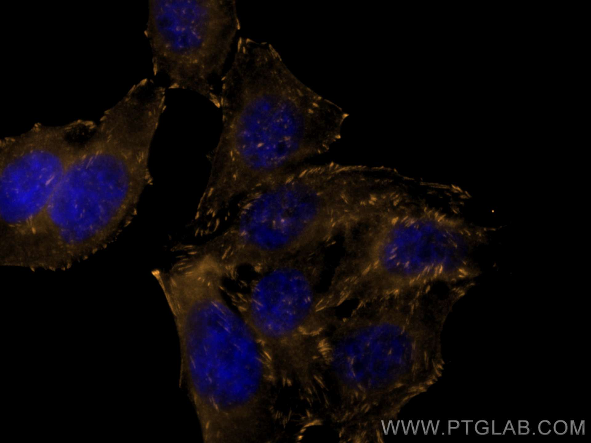 Immunofluorescence (IF) / fluorescent staining of HepG2 cells using CoraLite®555-conjugated VASP Polyclonal antibody (CL555-13472)