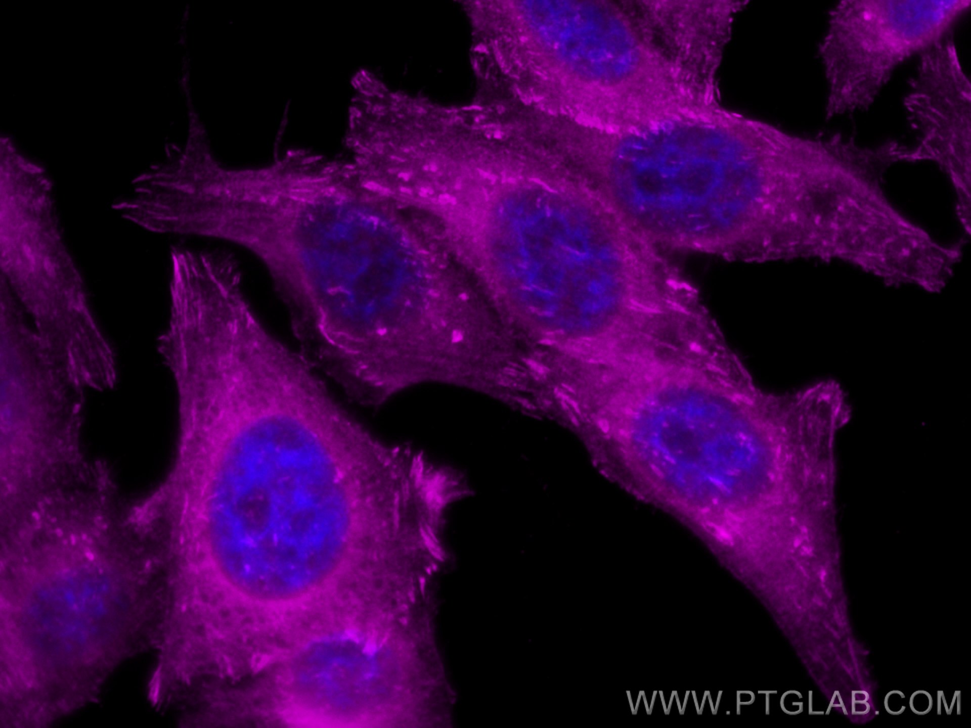 Immunofluorescence (IF) / fluorescent staining of HepG2 cells using CoraLite® Plus 647-conjugated VASP Polyclonal anti (CL647-13472)
