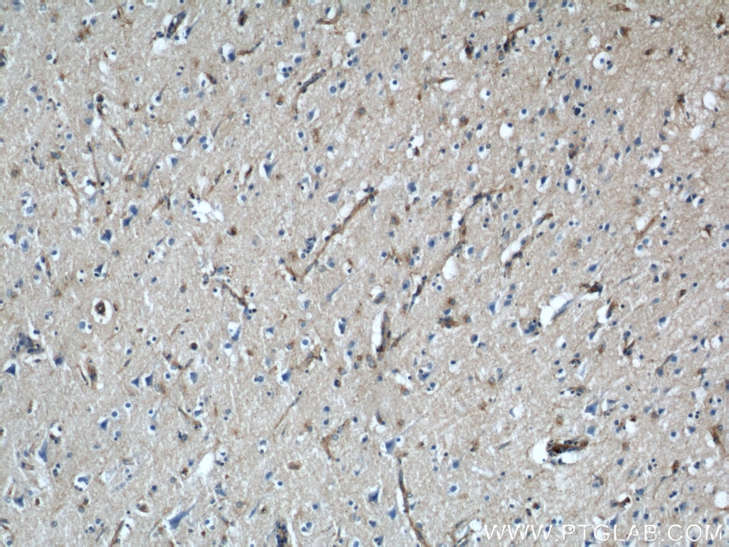 Immunohistochemistry (IHC) staining of human brain tissue using VAT1 Polyclonal antibody (22016-1-AP)