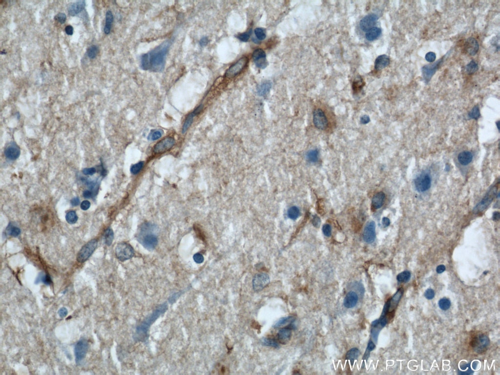 Immunohistochemistry (IHC) staining of human brain tissue using VAT1 Polyclonal antibody (22016-1-AP)