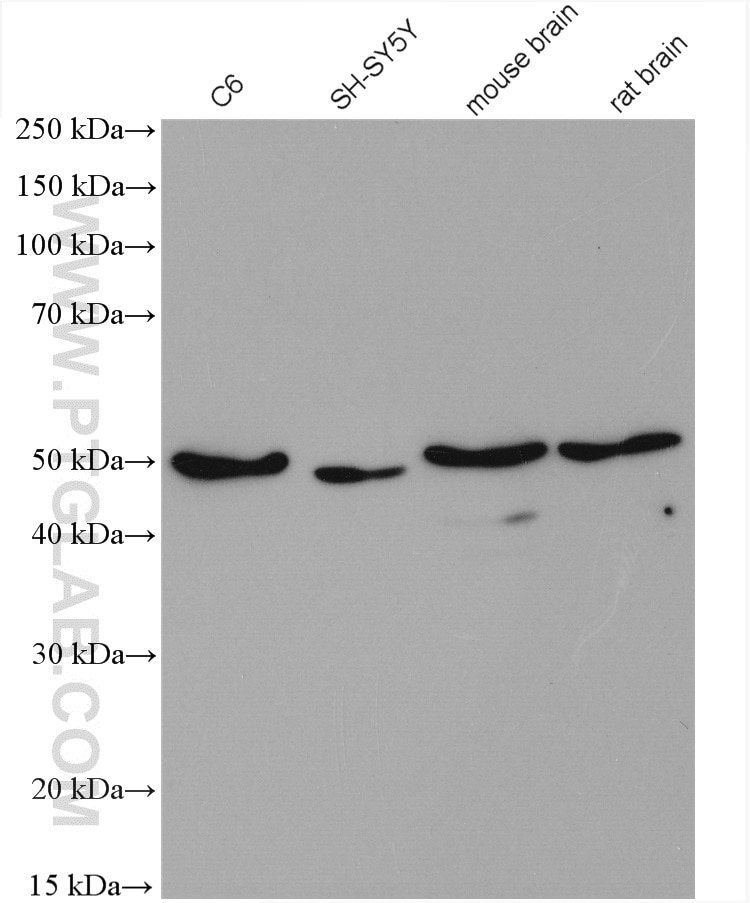 Western Blot (WB) analysis of various lysates using VAT1 Polyclonal antibody (22016-1-AP)