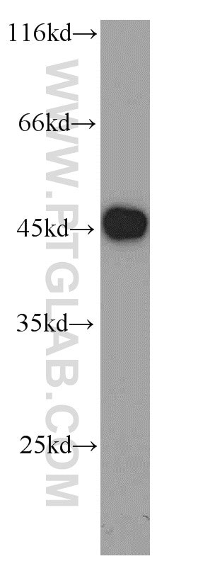 Western Blot (WB) analysis of Jurkat cells using VAT1 Polyclonal antibody (22016-1-AP)