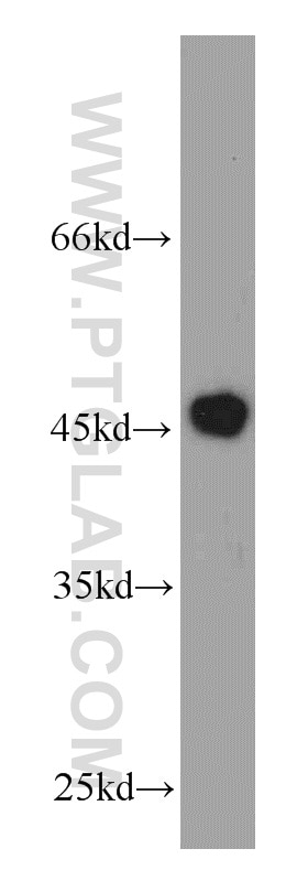 Western Blot (WB) analysis of MCF-7 cells using VAT1 Polyclonal antibody (22016-1-AP)