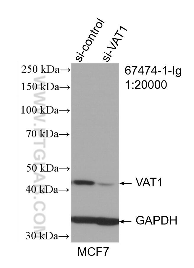 VAT1