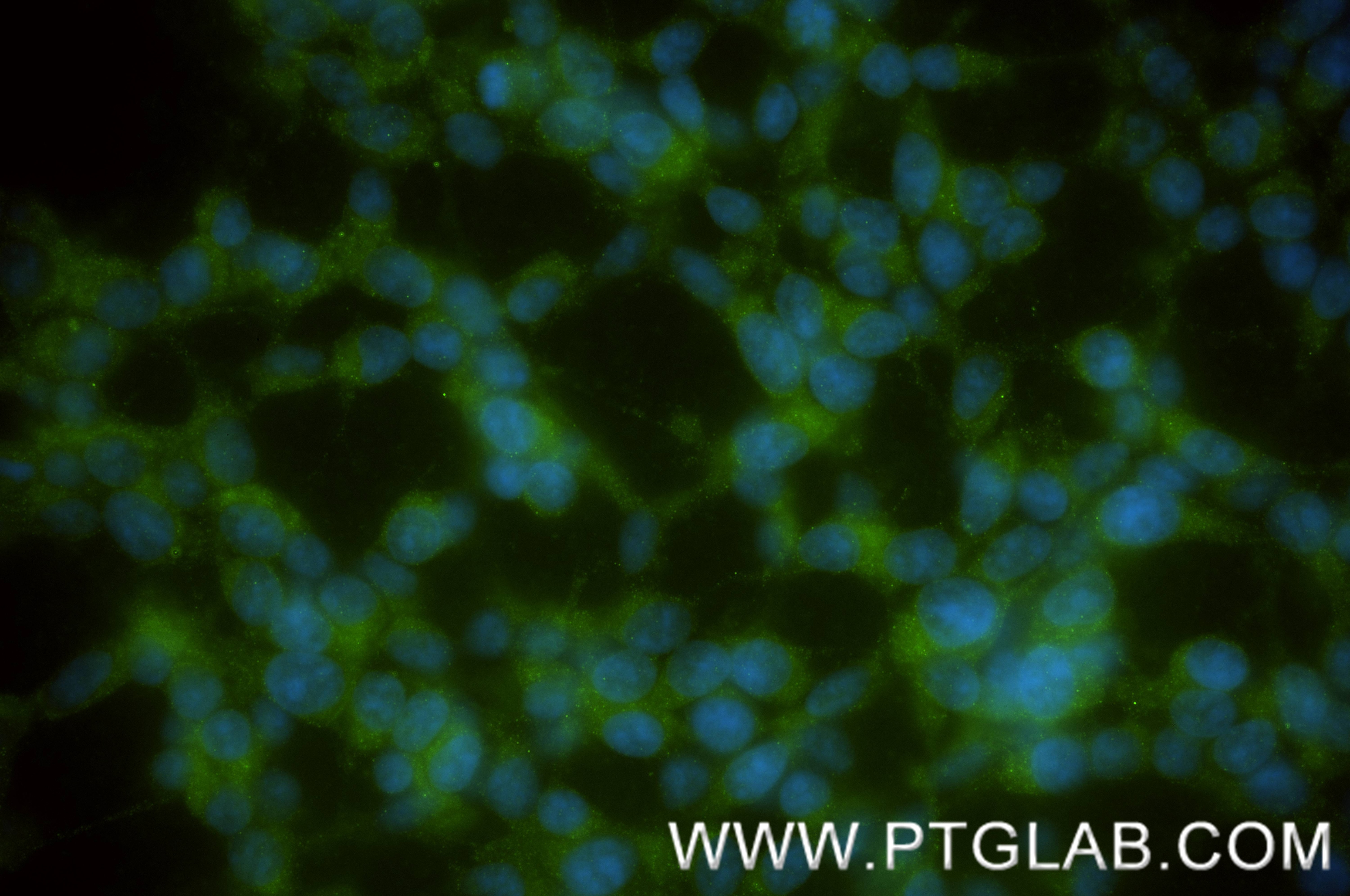 Immunofluorescence (IF) / fluorescent staining of SH-SY5Y cells using VAT1 Recombinant monoclonal antibody (86847-1-RR)
